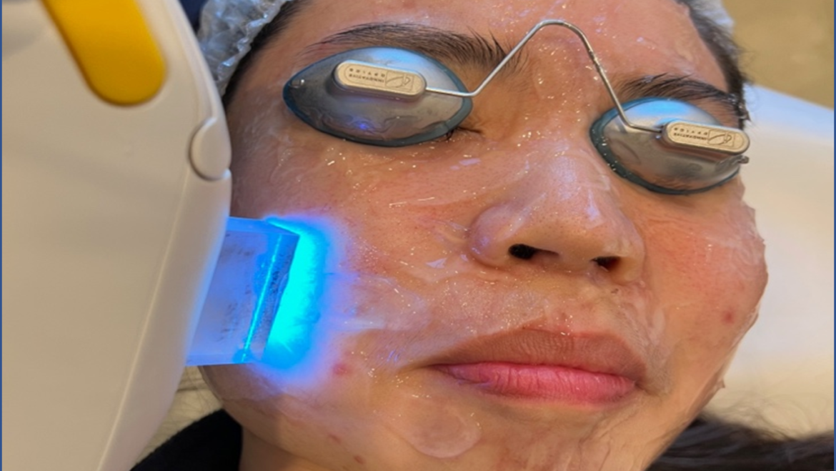 IPL Treatment for Eye Conditions: What You Need to Know
